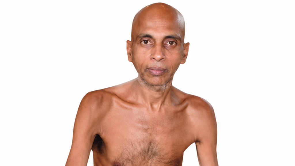 Thin, shirtless man with a bald head and visible chest hair, posing against a white background.