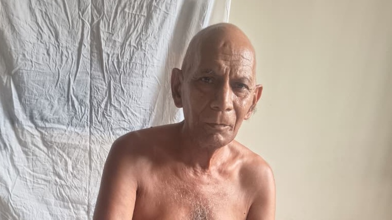 Shirtless elderly man with a bald head sits shirtless against a white sheet backdrop in a simple room.